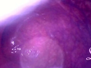 Look deep inside my ass!