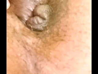 Asshole