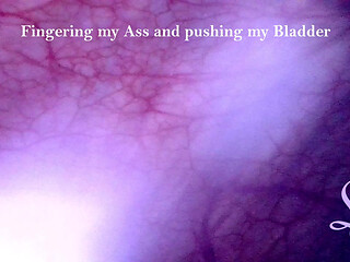 Watching my full bladder bulging out of my belly