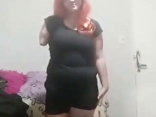 Double Amputee Entertaining You with Her Beauty