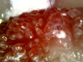 Medical Endoscope Oral Exam: Gummy Chewing, Extreme Teeth & Tongue Macro