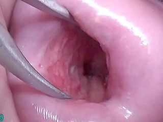 Japanese Wife Open Cervix Wide to watch inside Uterus