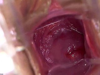 Kari - Peep Hole Providing Cervix