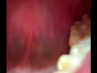 Inside the mouth