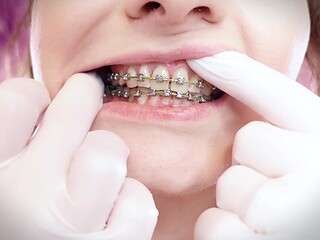 Arya Grander gets teethy with braces and latex gloves