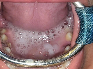 Throat Fuck with Open Mouth Gag and Spit Cum in Mouth