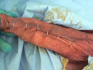 Penis Stapling for slave Renne Part1
