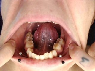 Climb Inside Wide Open Teeth Tongue Mouth Show