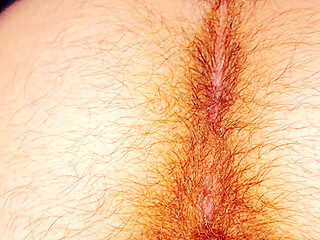 Hairy Butt of a 5-month Pregnant Woman