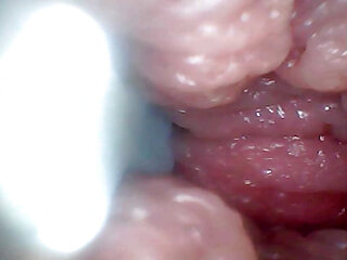 Endoscope Camera Shows the Most Sensitive Parts of the Penis Educational Video