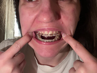 Licking Your Braces with Your Tongue