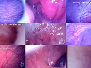 COMPILATION: Endoscope in my Dick, Ass and Bladder