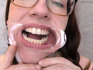 Glasses and Gape: 11-min Dental Speculum-stretched Drool Session
