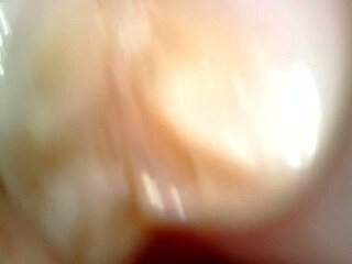 Medical Endoscope Oral Exam: Gummy Chewing, Extreme Teeth & Tongue Macro