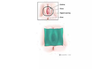 How to Use a Dental Dam