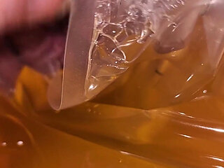 Cripple Problems 101: I Have to Drain Using a Catheter Because My Bladder Was Not Releasing