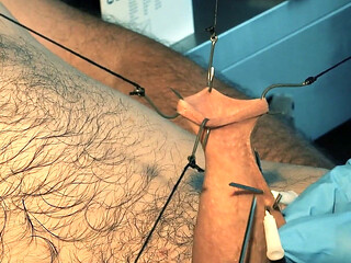 An Artful Study in Needles and Steel