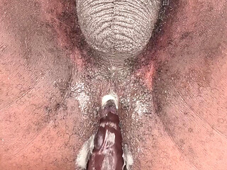 Eww.. My Pee is Yellow