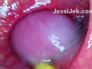 Plumber's Endoscope Stuk in My Ass Showed Hot Anal Creampie From Inside