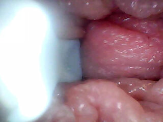 Endoscope camera shows the most sensitive parts of the penis Educational video