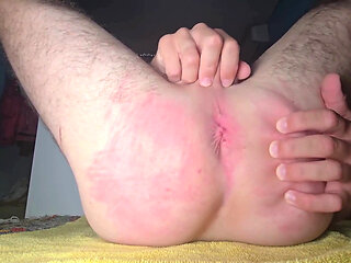 Amateur Anal Stretch