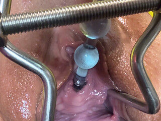 Stretching my Urethra With Anal Beads