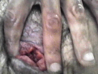 Self piss prolapse