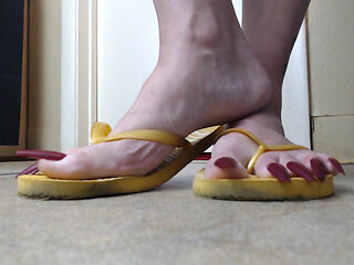 Toenails hanging off yellow flip flops