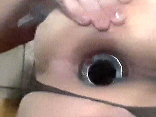 Anal dilation step by step