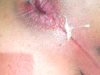 Widening the ass opening for easy orgasm.