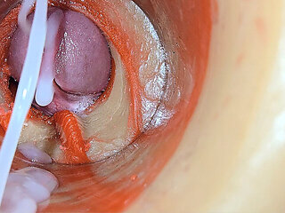 Female Insemination - Internal Camera Captures Deep Male Huge Ejaculation