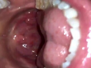 EB mouth show edit