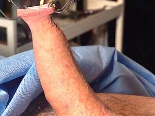 Needle CBT at It's Finest.