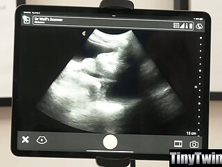 Doctor Uses His Ultrasound Machine To Show His Twink Patient Getting Finger-Fucked