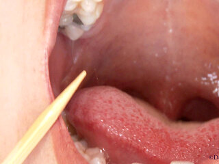 Exploring Danis Mouth Tongue Throat