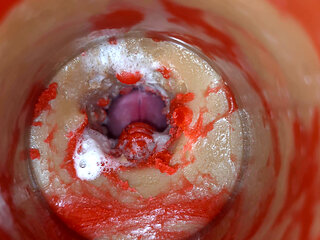 Insemination - Internal Camera Captures Deep Male Ejaculation