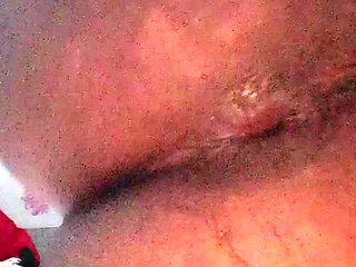 Masturbating with eggplant tore my anus