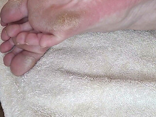 Best Cure for Callused Feet