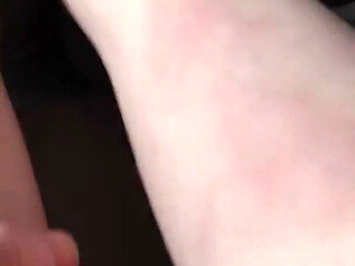 I Show You the Bruises on My Legs After Rough Sex