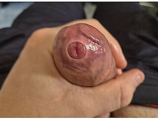 Tight Uncut Phimosis Cock Stretched Close Up Raw Foreskin Play