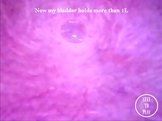 Can I fit the minicam AND a catheter inside my pee hole at the same time?