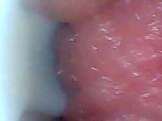 Endoscope Camera Shows the Most Sensitive Parts of the Penis Educational Video
