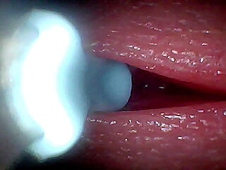 I couldn&rsquo_t believe what happens INSIDE the penis as sperm passes through (endoscopic footage)
