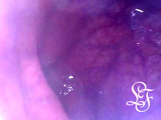 Exploring the Depths of my Ass with the Minicam!