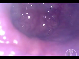 POV Extreme Deep Anal Examination!