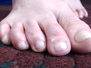 Natural toe closeup