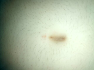 Wet belly button