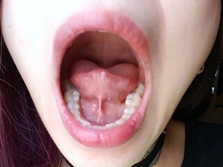 Mouth Examine