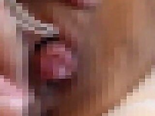 I Aspirate M Woman Clitoris and Am Fixed with Rubber