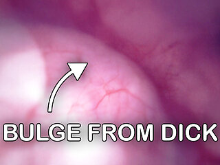 Fucked in my Pussy + Camera in my Bladder = Crazy Bulge! - Full Video on Fansly and Manyvids